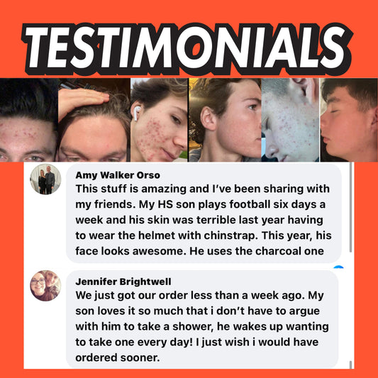 Coconut Cove Face Scrub (Medium Acne)