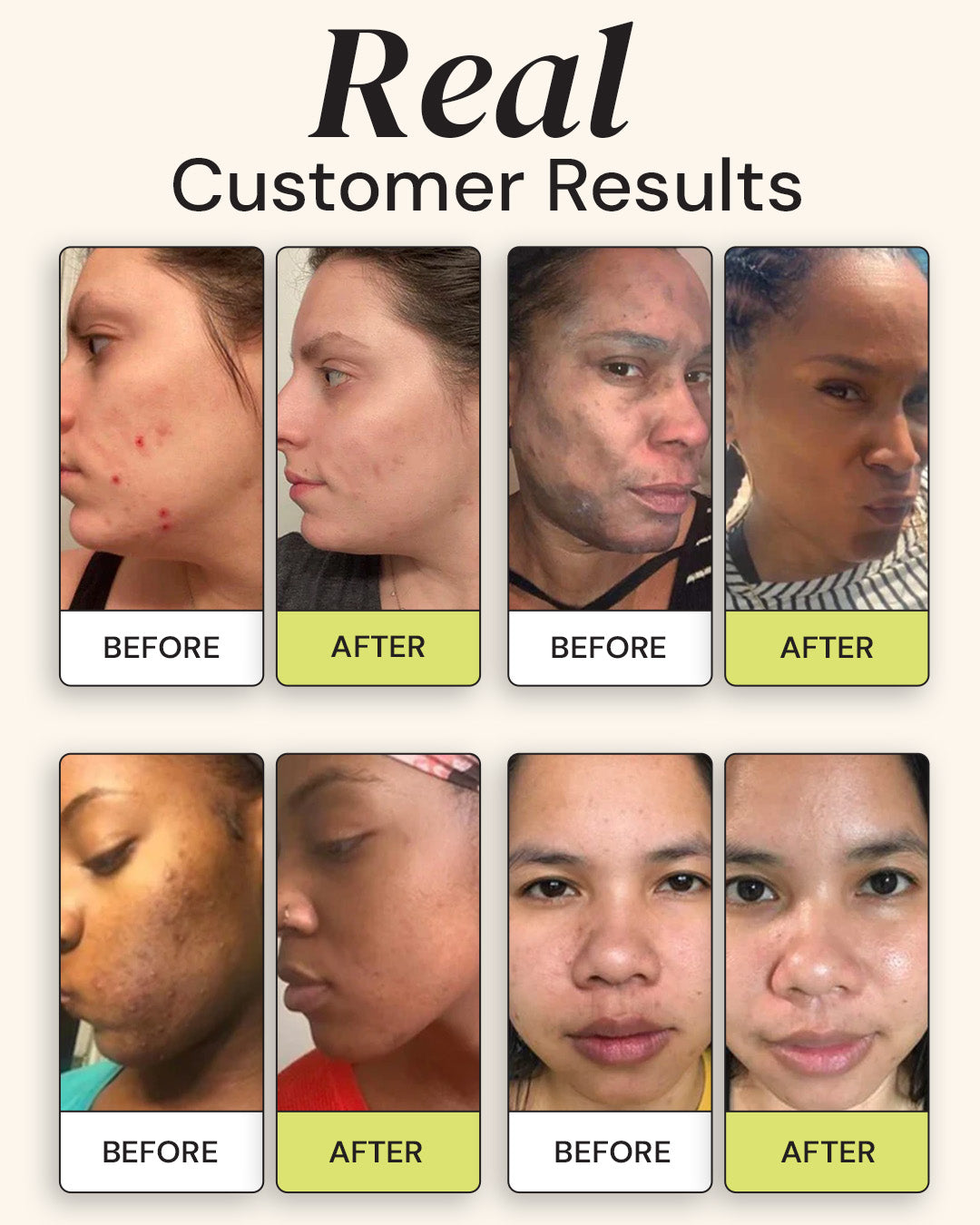 Superactive Serum