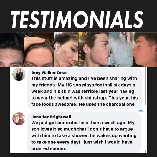 Activated Charcoal Face Scrub (Severe Acne)