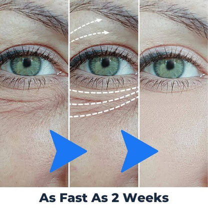 36 LED Eye Massager | Vibration & LED Light for a Refreshed, Radiant Eye Area