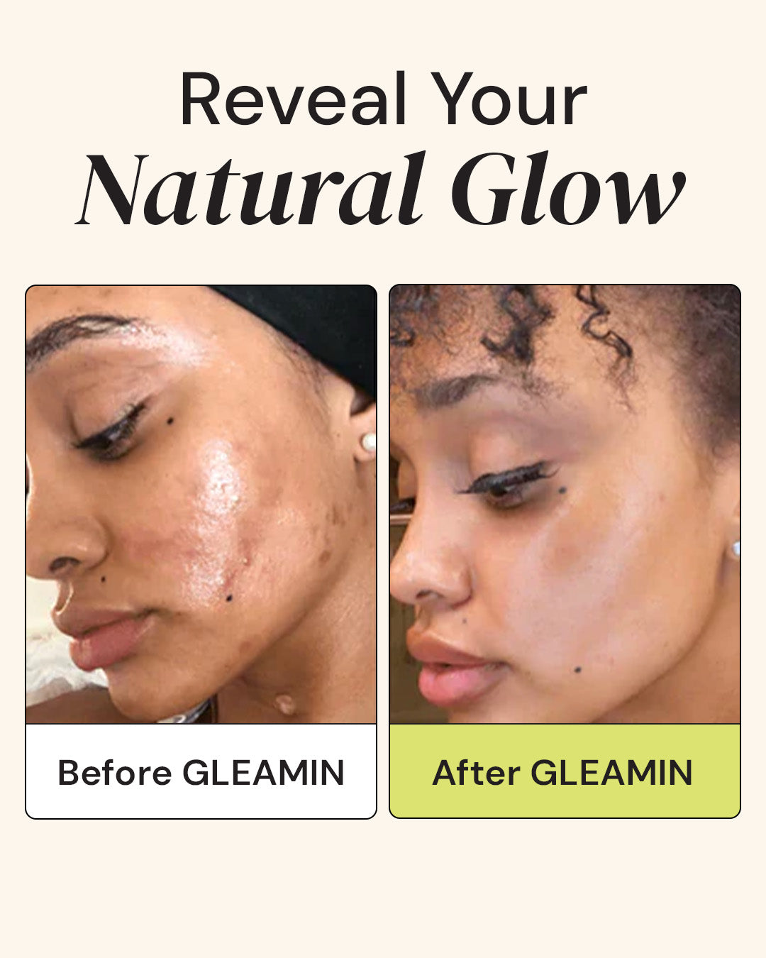 Superactive Serum