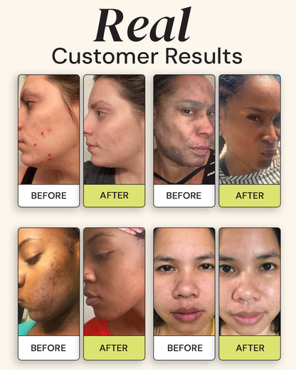 Superactive Serum