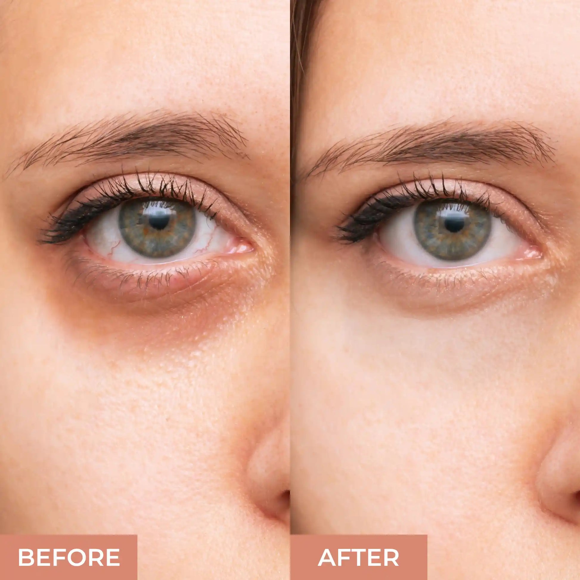 Prolux Concealer For Dark Circles, Good Concealer For Dark Circles, Great Concealer For Dark Circles