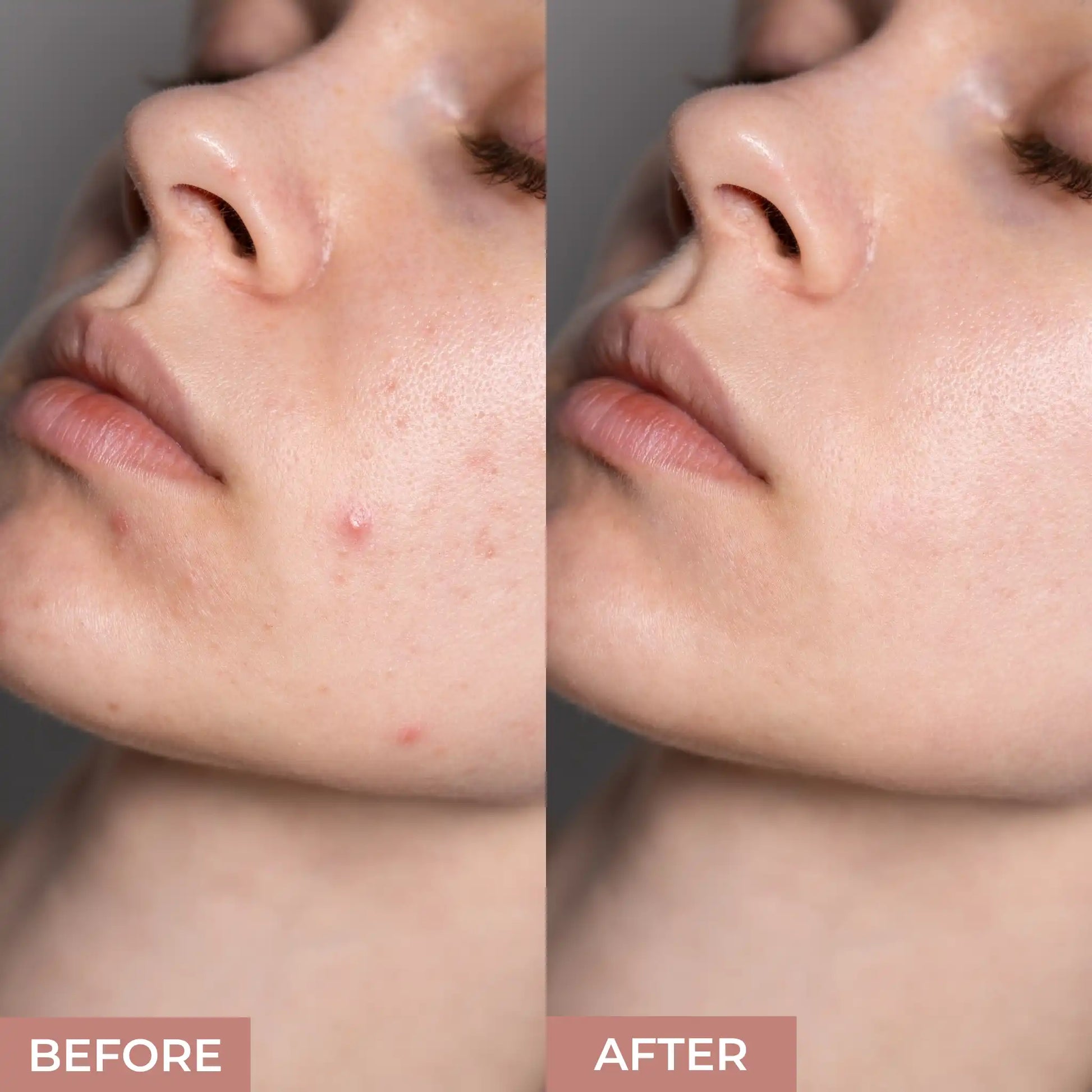 Get Smooth, Poreless Skin with Best Pore Concealing Primer by Prolux ...