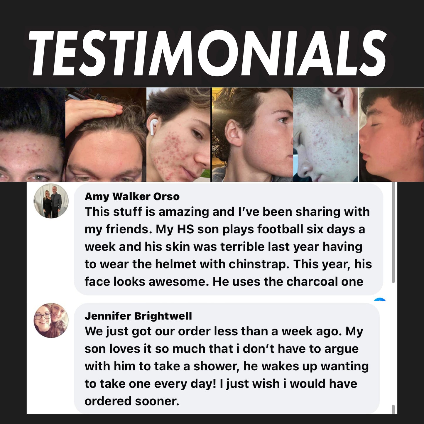 Activated Charcoal Face Scrub (Severe Acne)