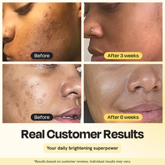 Superactive Serum